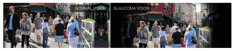 glaucoma-banner